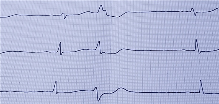 soi cầu bạch thủ miền nam miễn phí